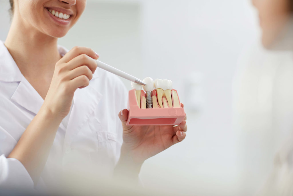 Life-Changing Benefits Of Dental Implants